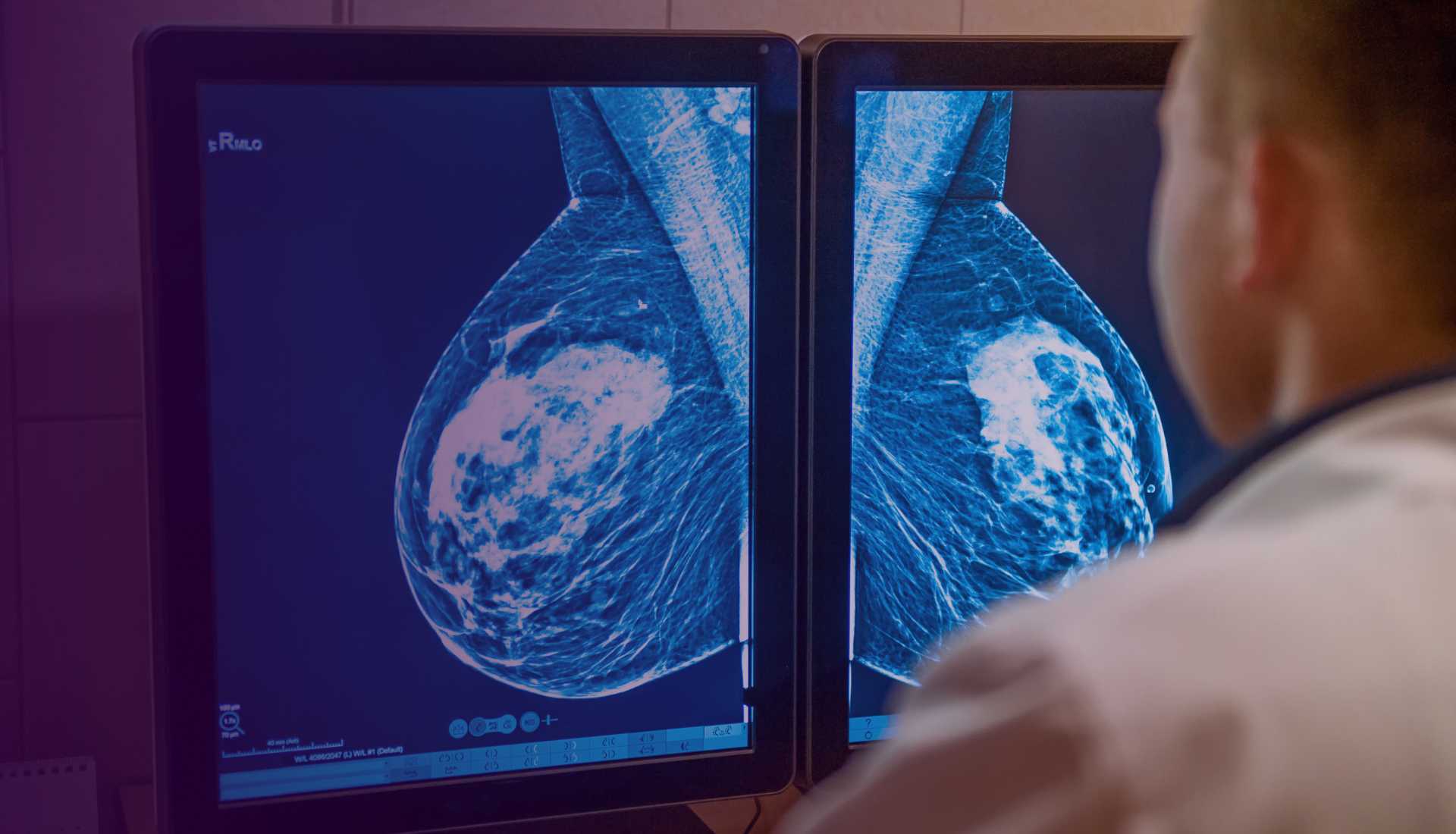 Mammography Near Me